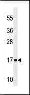 NADH:Ubiquinone Oxidoreductase Subunit A12 antibody, LS-C158373, Lifespan Biosciences, Western Blot image 