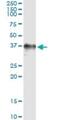 RAD51 Recombinase antibody, H00005888-M02, Novus Biologicals, Immunoprecipitation image 