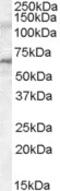 Interleukin 1 Receptor Associated Kinase 3 antibody, MBS421426, MyBioSource, Western Blot image 