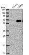 Tubulointerstitial Nephritis Antigen antibody, PA5-57267, Invitrogen Antibodies, Western Blot image 