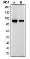 Transglutaminase 2 antibody, LS-C352936, Lifespan Biosciences, Western Blot image 