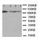 Heat Shock Protein Family H (Hsp110) Member 1 antibody, LS-C312764, Lifespan Biosciences, Western Blot image 