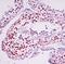 RAD51 Recombinase antibody, MA5-14419, Invitrogen Antibodies, Immunohistochemistry frozen image 