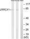 Leucine Rich Repeat Containing 41 antibody, A30736, Boster Biological Technology, Western Blot image 