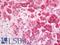 HLA class II histocompatibility antigen, DQ alpha 1 chain antibody, LS-C316748, Lifespan Biosciences, Immunohistochemistry paraffin image 