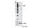 Wolframin ER Transmembrane Glycoprotein antibody, 8749S, Cell Signaling Technology, Western Blot image 