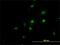 RNA Binding Motif Protein 39 antibody, H00009584-M01, Novus Biologicals, Immunocytochemistry image 