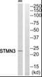 Stathmin 3 antibody, PA5-39484, Invitrogen Antibodies, Western Blot image 