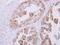 Ribokinase antibody, PA5-30794, Invitrogen Antibodies, Immunohistochemistry paraffin image 