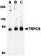 Transient Receptor Potential Cation Channel Subfamily C Member 6 antibody, orb74750, Biorbyt, Western Blot image 