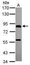 PiggyBac Transposable Element Derived 1 antibody, NBP2-19782, Novus Biologicals, Western Blot image 