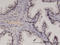 RecQ Like Helicase 4 antibody, LS-C133999, Lifespan Biosciences, Immunohistochemistry frozen image 