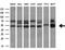 Tubulin Folding Cofactor E Like antibody, M14442-1, Boster Biological Technology, Western Blot image 