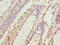 Tubulin Beta 6 Class V antibody, LS-C372191, Lifespan Biosciences, Immunohistochemistry paraffin image 