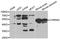 Cholinergic Receptor Nicotinic Alpha 5 Subunit antibody, STJ23135, St John