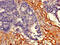Tryptophan Hydroxylase 2 antibody, CSB-PA809000LA01HU, Cusabio, Immunohistochemistry paraffin image 