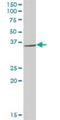 Ring Finger Protein 144A antibody, H00009781-B02P, Novus Biologicals, Western Blot image 