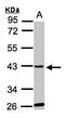 Glycine-N-Acyltransferase Like 1 antibody, LS-B11863, Lifespan Biosciences, Western Blot image 