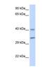 AlkB Homolog 3, Alpha-Ketoglutaratedependent Dioxygenase antibody, NBP1-57586, Novus Biologicals, Western Blot image 