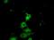 Protein Kinase CAMP-Dependent Type II Regulatory Subunit Alpha antibody, GTX83826, GeneTex, Immunofluorescence image 