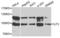 Interleukin Enhancer Binding Factor 3 antibody, LS-C332118, Lifespan Biosciences, Western Blot image 
