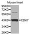 Cyclin Dependent Kinase 7 antibody, orb135242, Biorbyt, Western Blot image 
