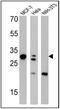 Galectin 3 antibody, MA1-940, Invitrogen Antibodies, Western Blot image 