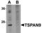 Tetraspanin 9 antibody, TA306902, Origene, Western Blot image 