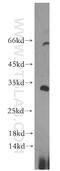 Kruppel Like Factor 7 antibody, 13125-1-AP, Proteintech Group, Western Blot image 