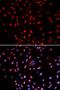 DNA Polymerase Delta 1, Catalytic Subunit antibody, LS-C333982, Lifespan Biosciences, Immunofluorescence image 