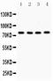 Protein Kinase C Alpha antibody, PB9318, Boster Biological Technology, Western Blot image 