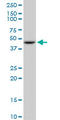 Glutamic-Oxaloacetic Transaminase 2 antibody, LS-C197329, Lifespan Biosciences, Western Blot image 