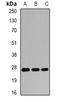 Eukaryotic Translation Initiation Factor 6 antibody, orb378046, Biorbyt, Western Blot image 