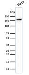 DNA Topoisomerase II Alpha antibody, GTX35138, GeneTex, Western Blot image 