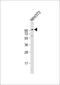 Dystroglycan 1 antibody, 57-475, ProSci, Western Blot image 