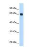 Kininogen 1 antibody, NBP1-53176, Novus Biologicals, Western Blot image 