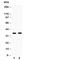 Hydroxysteroid 17-Beta Dehydrogenase 6 antibody, R30457, NSJ Bioreagents, Western Blot image 