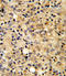 Cartilage Oligomeric Matrix Protein antibody, LS-C166937, Lifespan Biosciences, Immunohistochemistry frozen image 