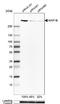 Microtubule Associated Protein 1B antibody, NBP1-81261, Novus Biologicals, Western Blot image 