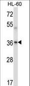 Protein Kinase CAMP-Activated Catalytic Subunit Beta antibody, LS-C164545, Lifespan Biosciences, Western Blot image 