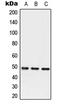 Serpin Family A Member 3 antibody, MBS822196, MyBioSource, Western Blot image 