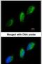 Tyrosine Kinase 2 antibody, PA5-21529, Invitrogen Antibodies, Immunofluorescence image 