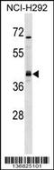 Undifferentiated embryonic cell transcription factor 1 antibody, 58-899, ProSci, Western Blot image 