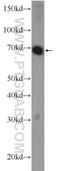 REST Corepressor 3 antibody, 25970-1-AP, Proteintech Group, Western Blot image 