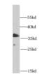 PHD Finger Protein 11 antibody, FNab06378, FineTest, Western Blot image 