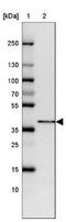 LRAT Domain Containing 2 antibody, NBP2-47459, Novus Biologicals, Western Blot image 
