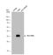 Major Histocompatibility Complex, Class II, DR Alpha antibody, NBP1-33458, Novus Biologicals, Western Blot image 