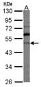 Rho GDP Dissociation Inhibitor Alpha antibody, NBP1-31528, Novus Biologicals, Western Blot image 