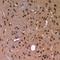 Sperm Associated Antigen 16 antibody, LS-C668294, Lifespan Biosciences, Immunohistochemistry paraffin image 