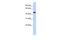 Gamma-Aminobutyric Acid Type A Receptor Rho2 Subunit antibody, PA5-41008, Invitrogen Antibodies, Western Blot image 